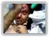 injured protester